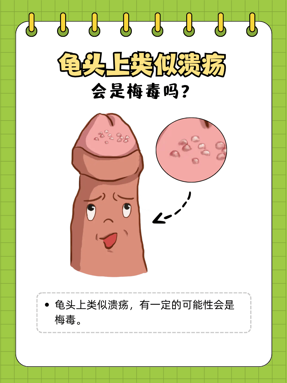 龟头上出现类似溃疡的病灶,确实可能与梅毒有关,但不能仅凭这一症状