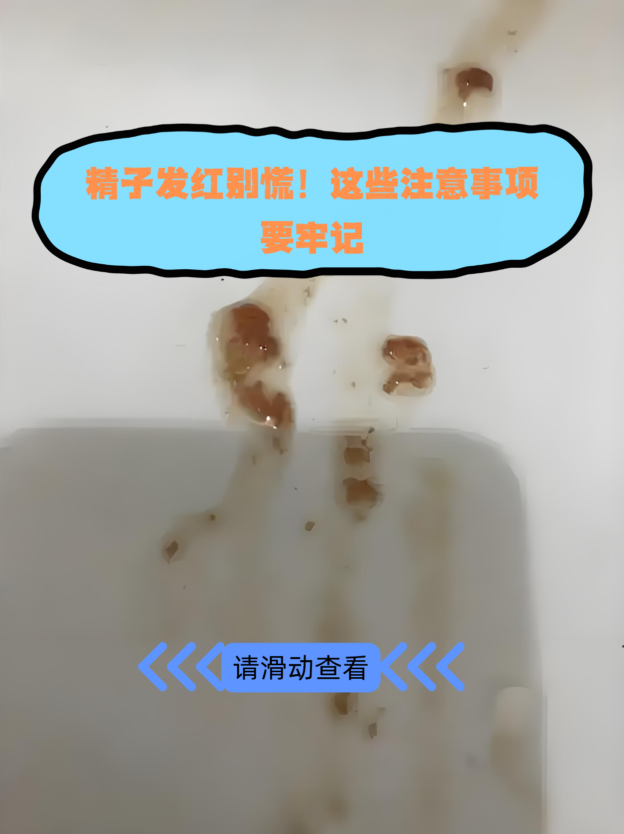 精子发红,其实也就是血精,需从就医,生活,饮食等