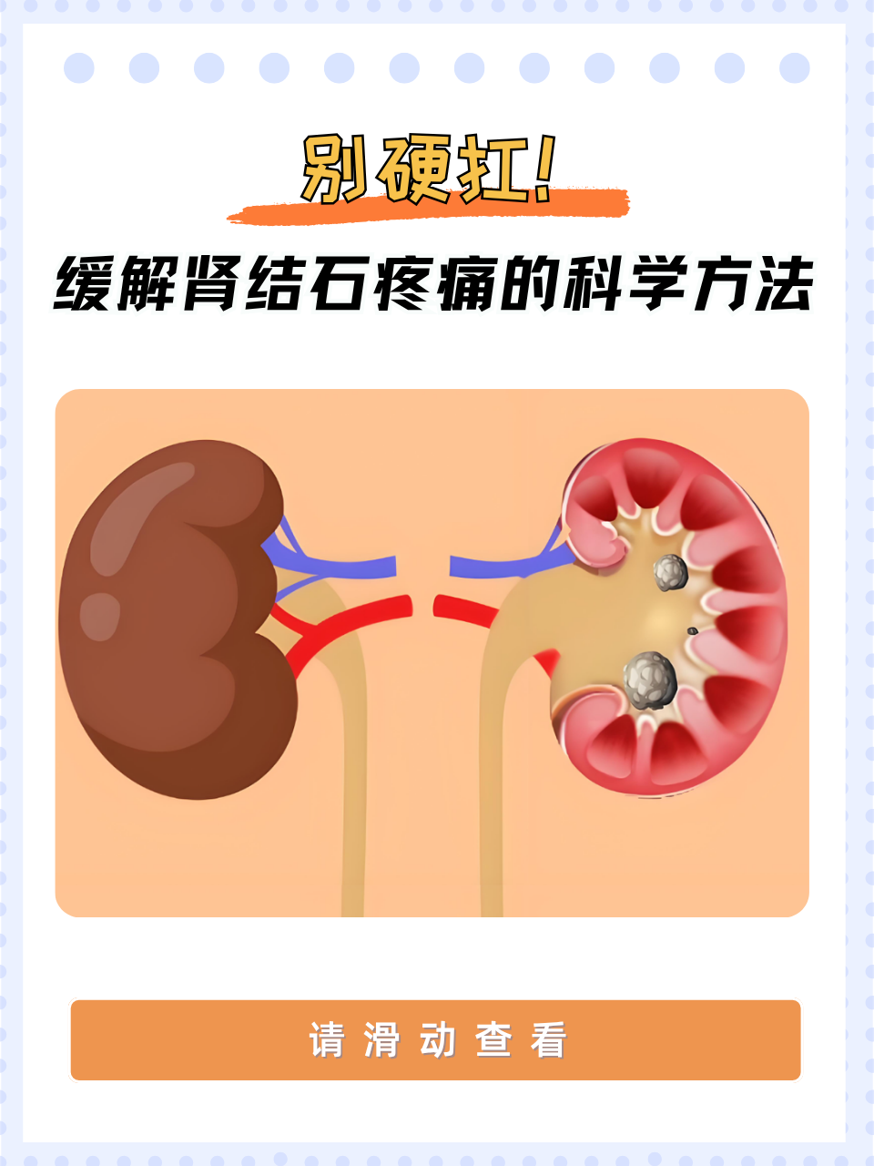 缓解肾结石疼痛的科学方法