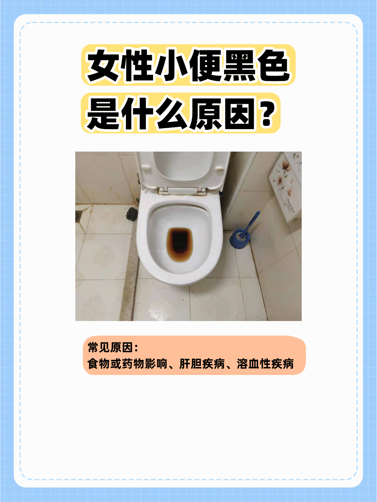 女性如果发现小便颜色发黑,先别慌!