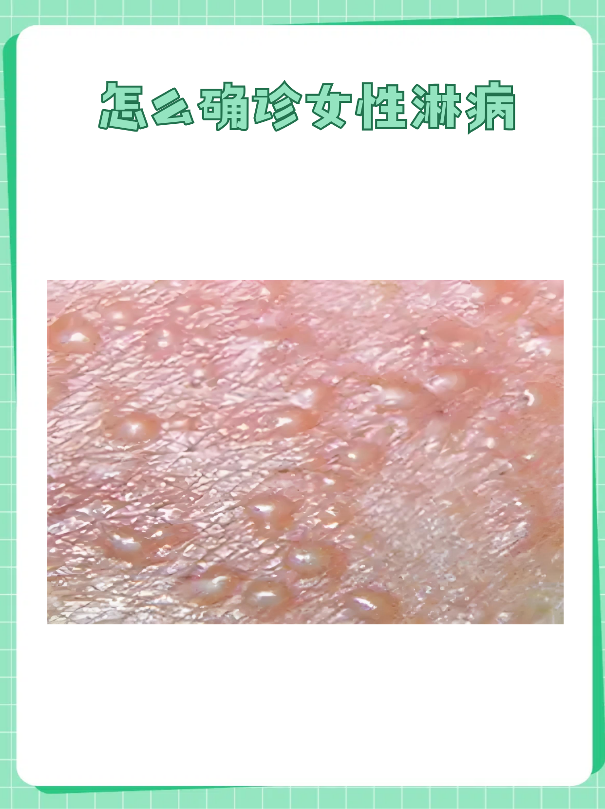  疫情的症状有哪些表现(疫情的的症状表现)
