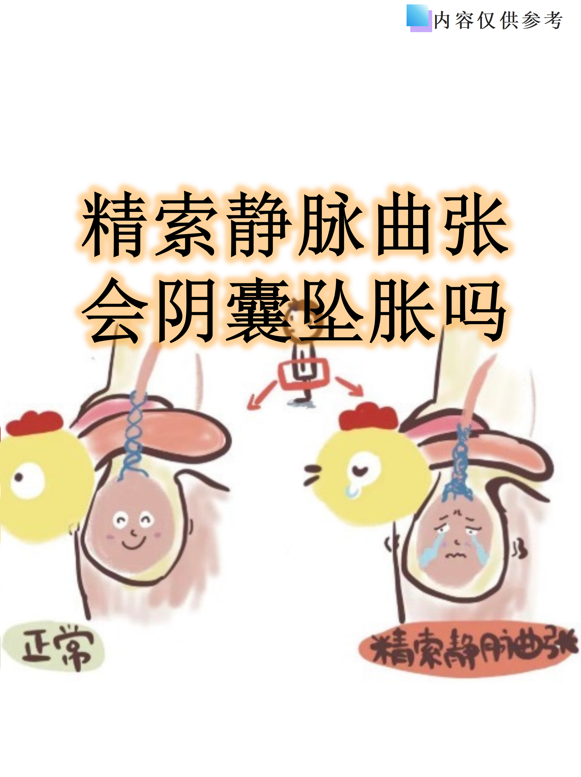 精索静脉曲张会阴囊坠胀吗