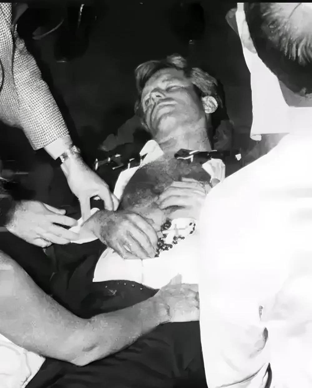 肯尼迪总统肯尼迪遇刺事件刺杀肯尼迪林肯遇刺肯尼迪遇刺头盖骨图片