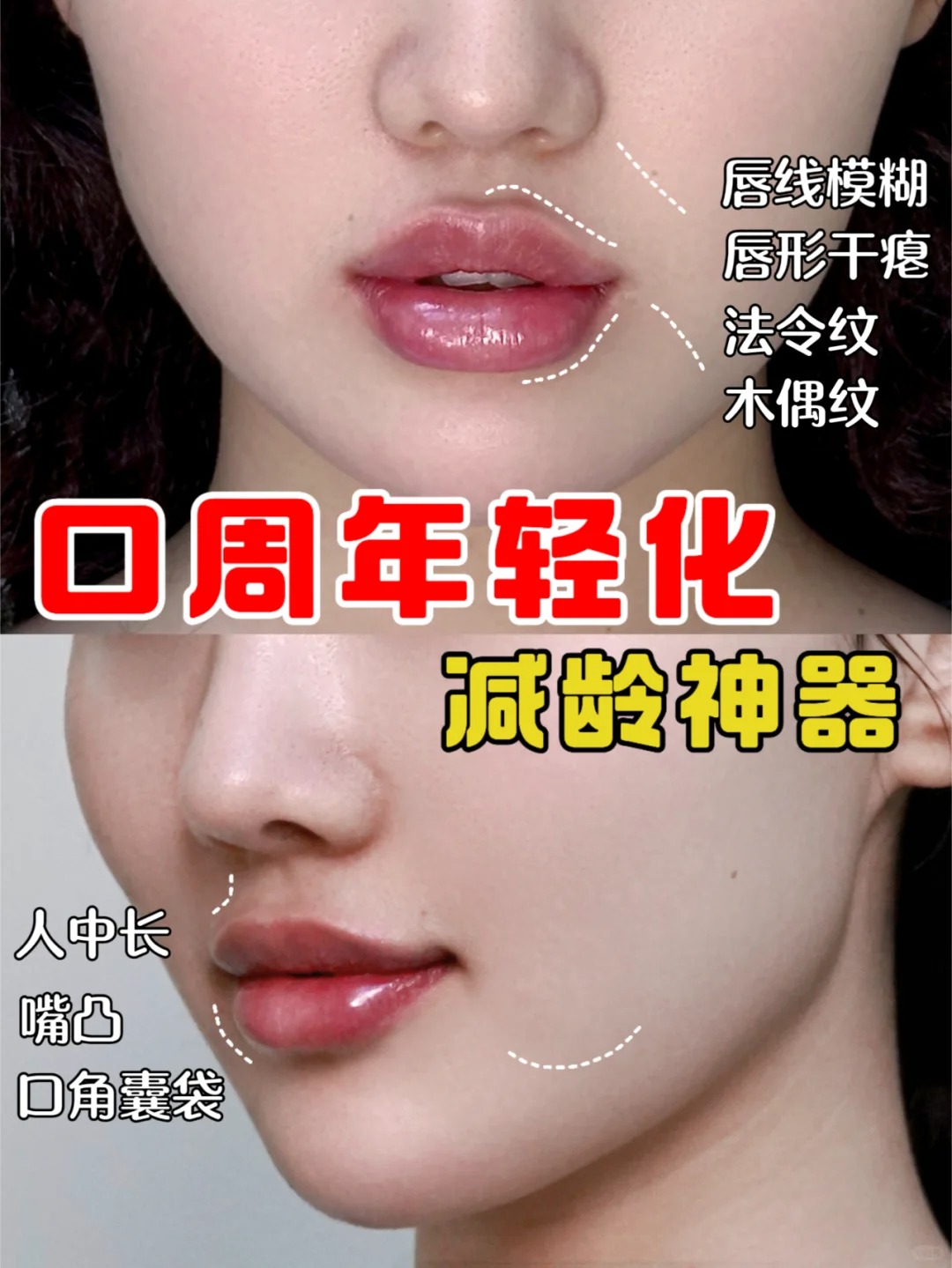 周问题包括鼻基底凹陷法令纹木偶纹嘴唇干瘪嘴角下垂下颌线模糊