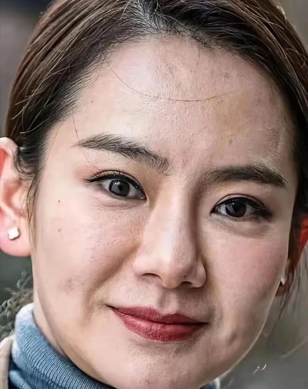 戚薇素颜还不如乡村大妈,脸上坑坑洼洼,很多斑点,毛孔粗大,蜡黄的皮肤