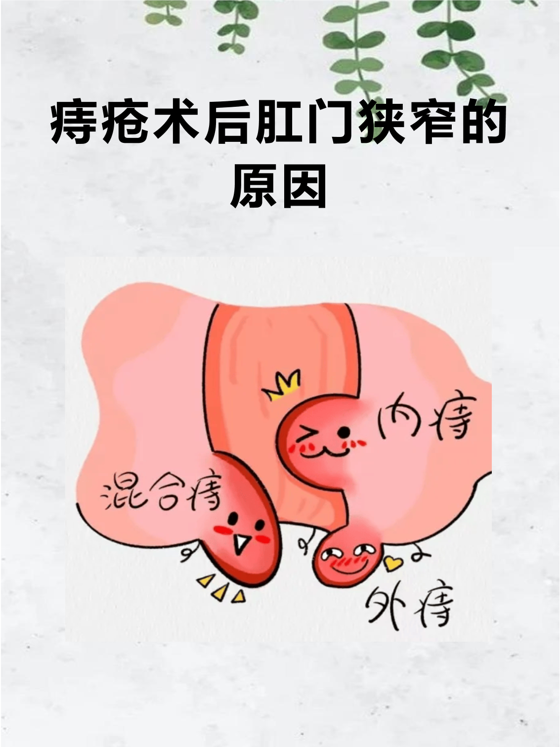 痔疮术后肛门狭窄的原因