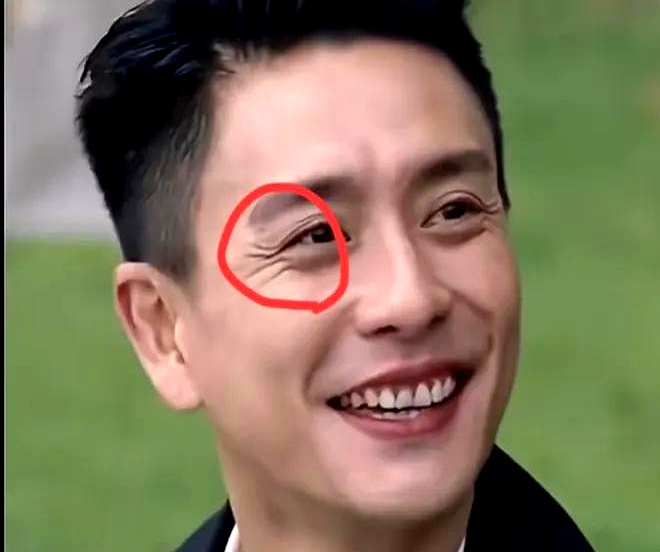 李承德这个面部整体厚实圆润,但是气色混浊,桃花眼,笑起来眼尾炸花