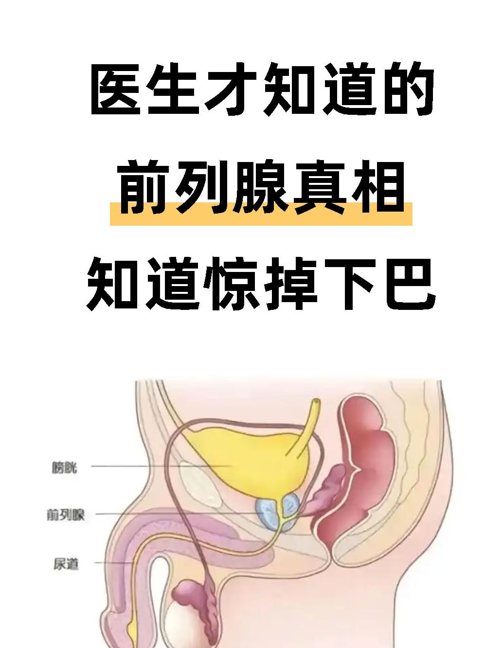 很多人觉得前列腺增生不好意思说,以为尿频尿急忍忍就行,但拖着反而