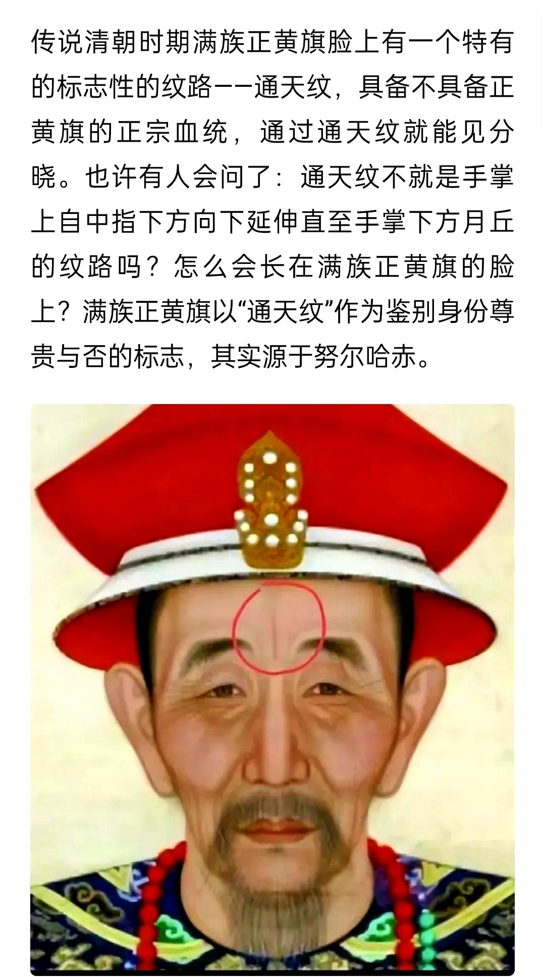 再也不愁了,没想到一条眉间竖纹还有这种解读,通天