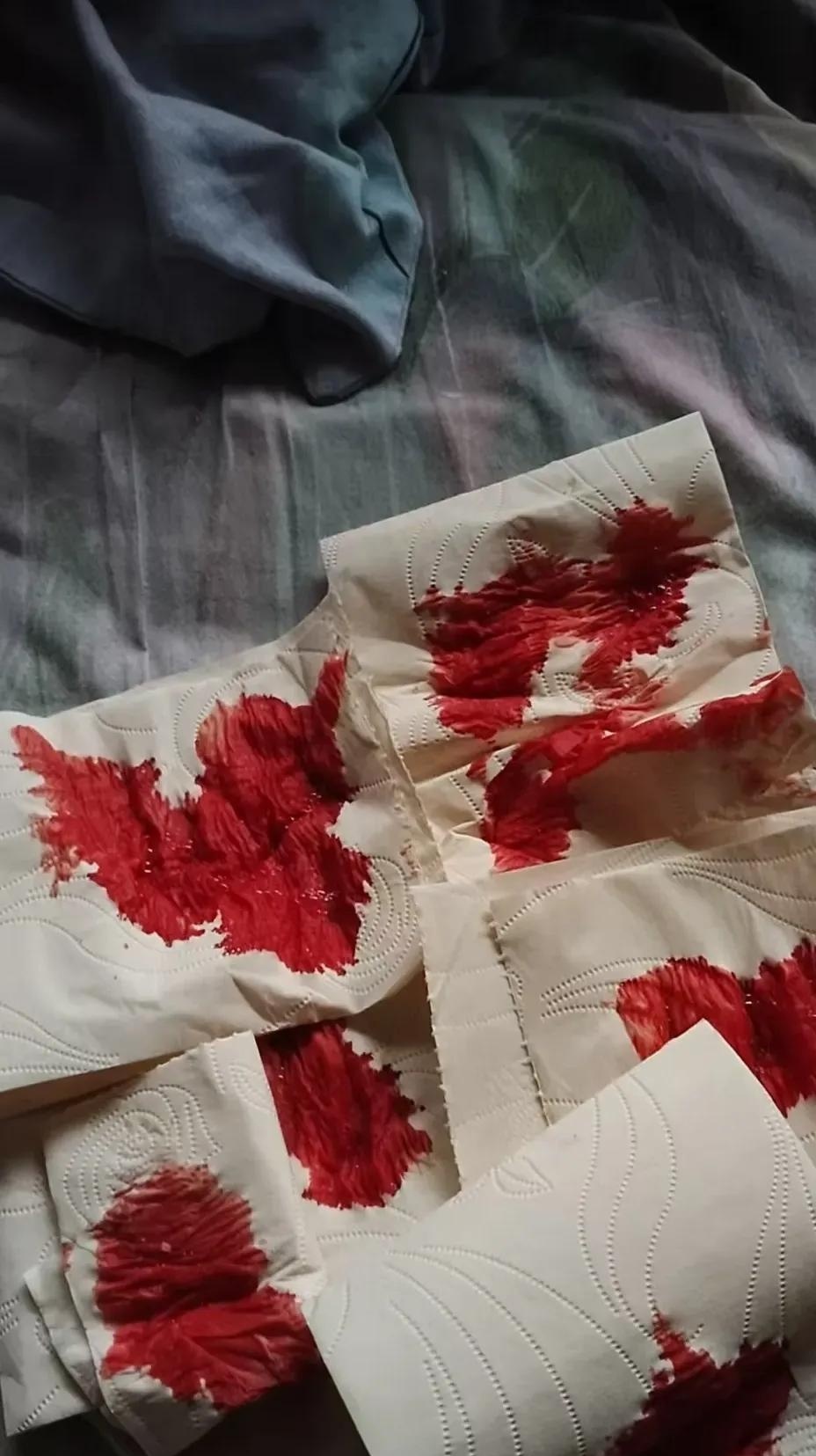 支架手术将近10个月了,最近,心脏舒服了很多,我以为