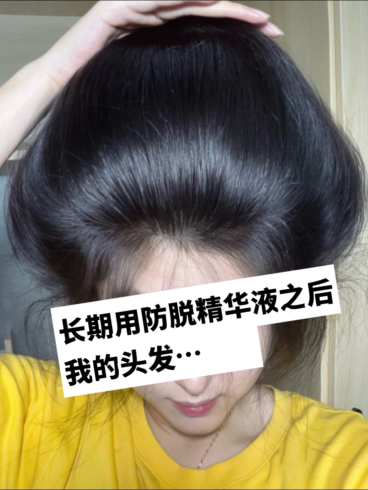 生发液什么牌子最有效果?