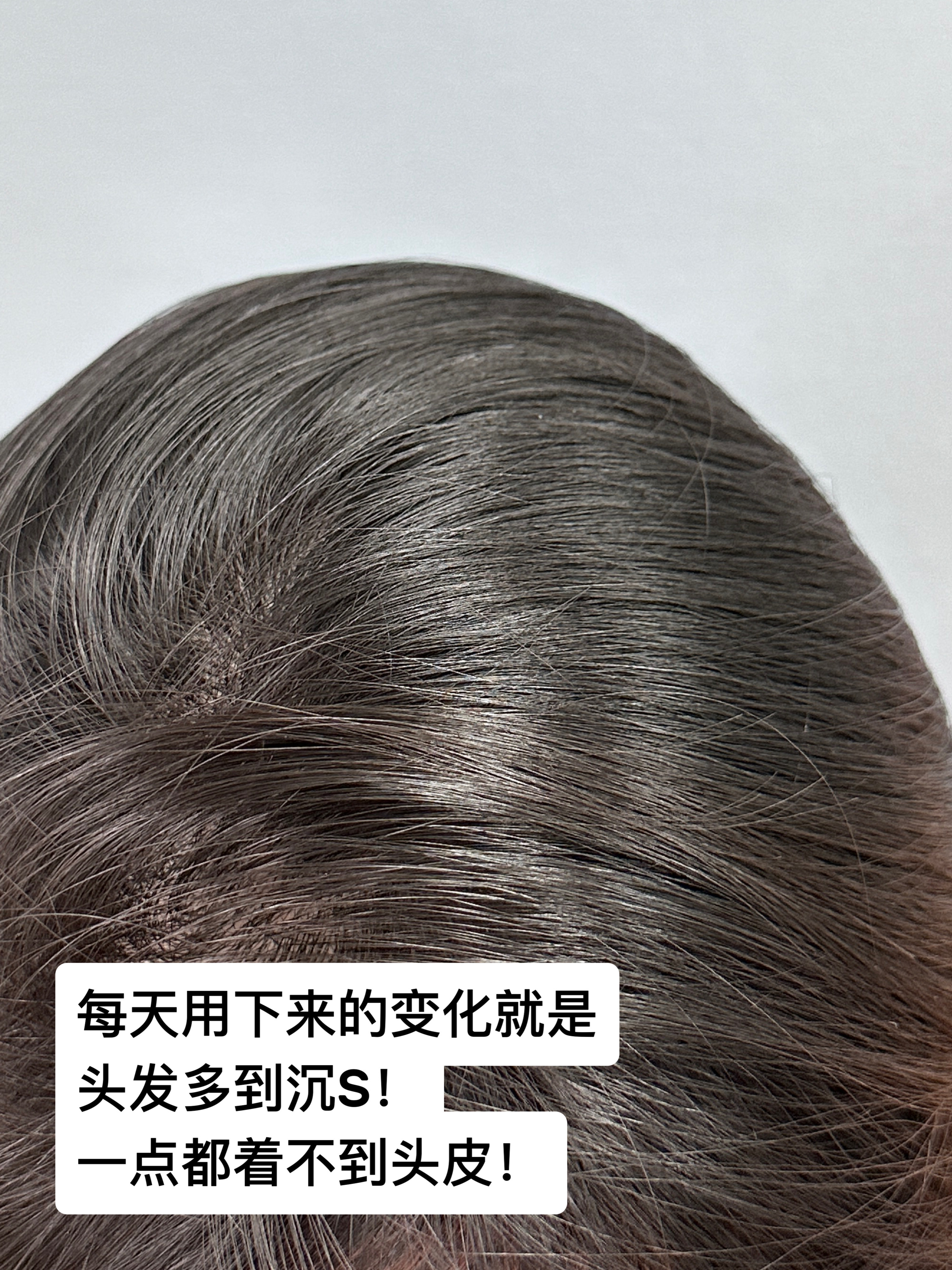 防脱育发哪个品牌产品好 生发育发最有效的产品排名 防脱最好的