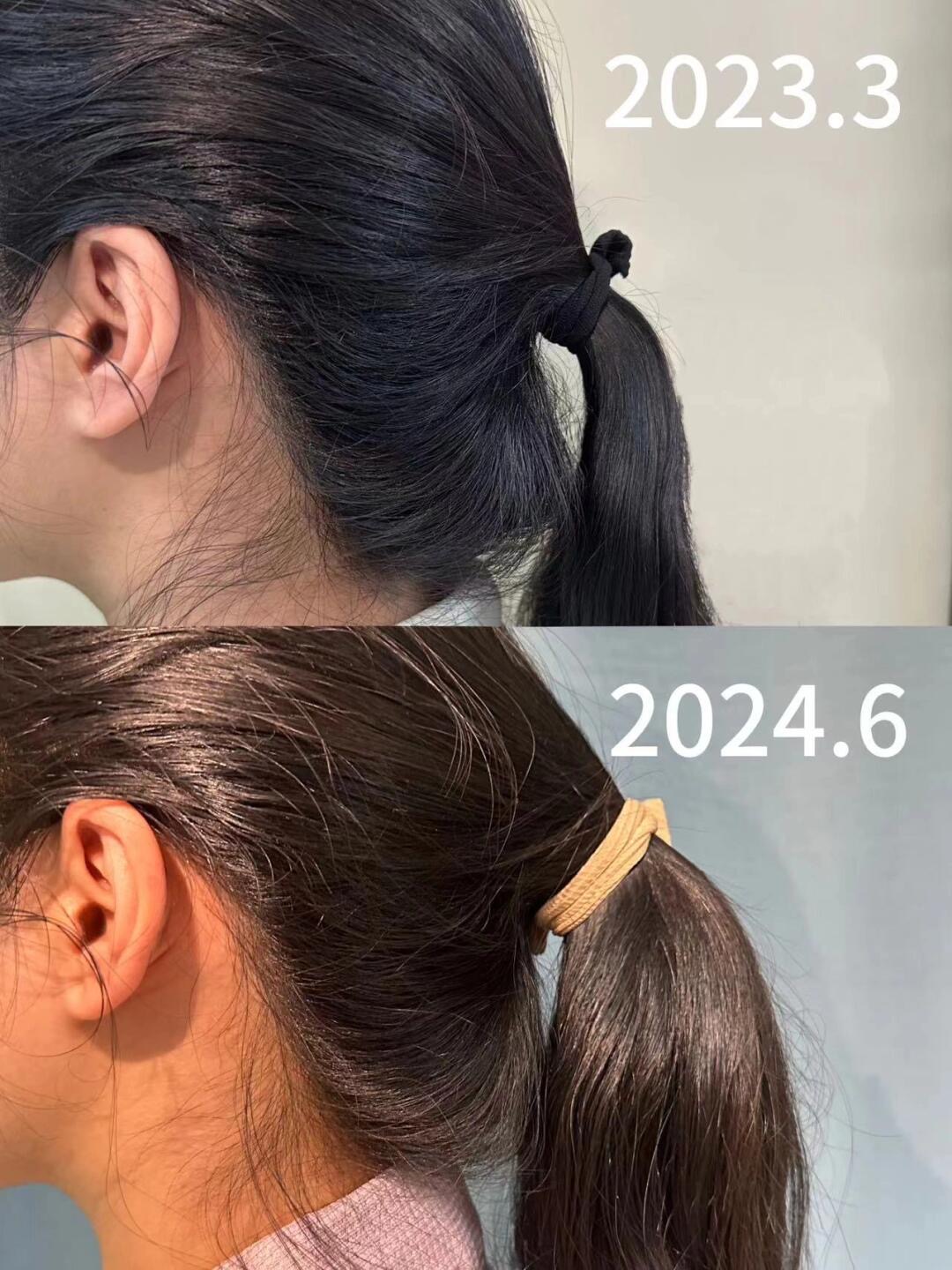 脱发必看拯救日益稀疏的头顶