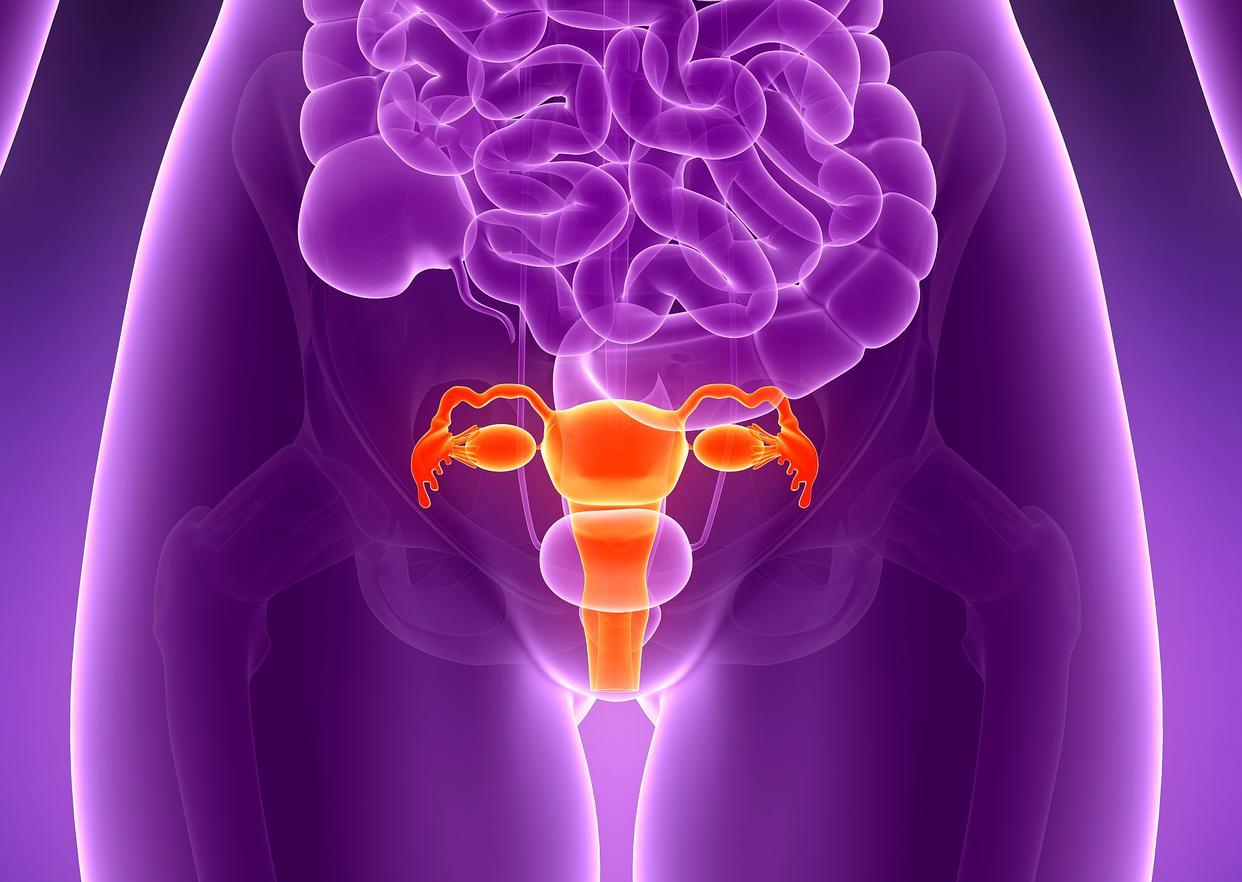 卵巢癌,能从肚子上的变化瞧出点啥?