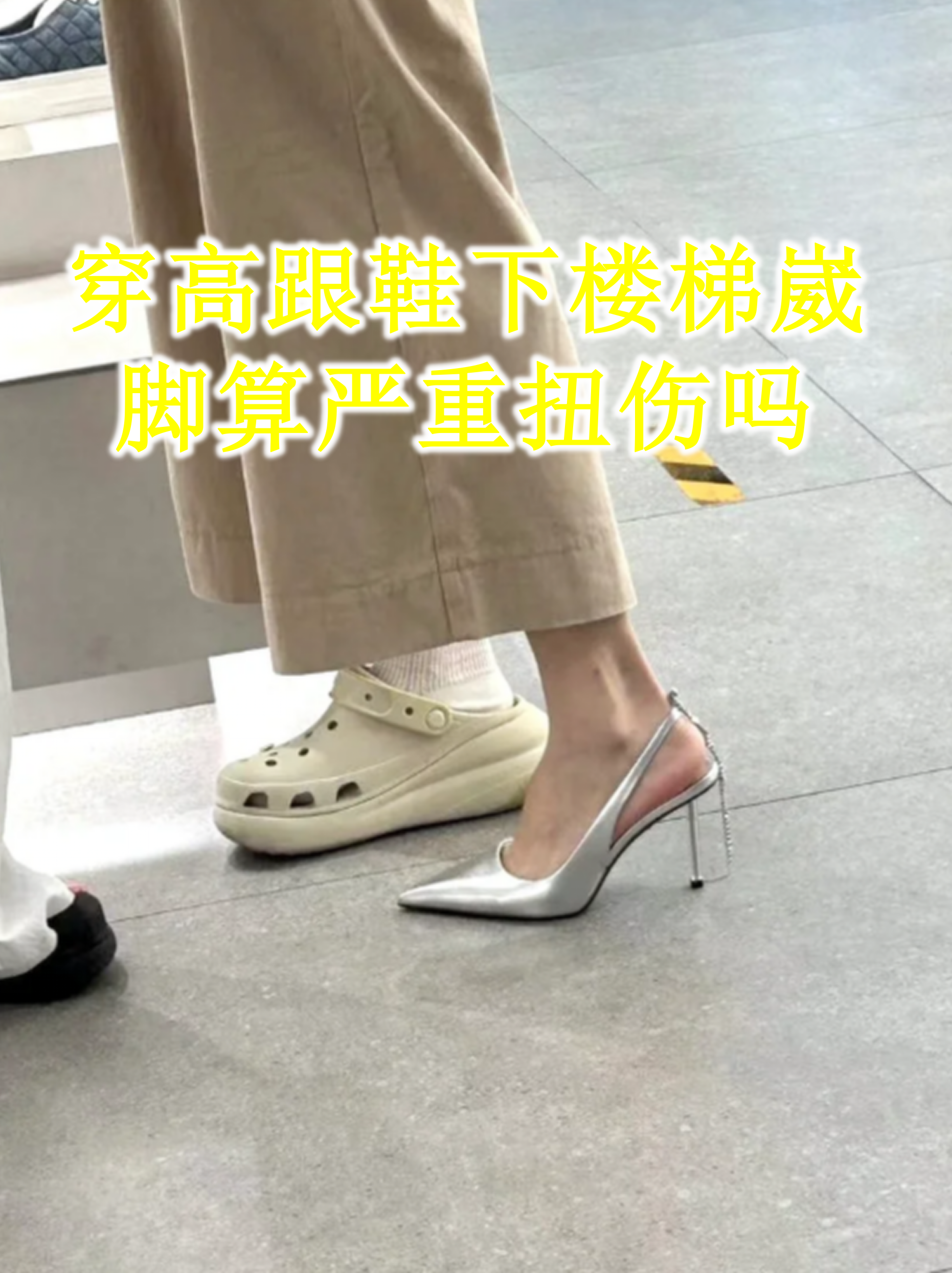 穿高跟鞋下楼梯崴脚算严重扭伤吗