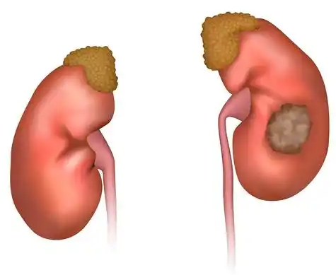 包含地坛医院住院办理陪诊挂号化验单专业解读,清楚了解病情的词条 包含地坛医院住院办理陪诊挂号化验单专业解读,清楚了解病情的词条