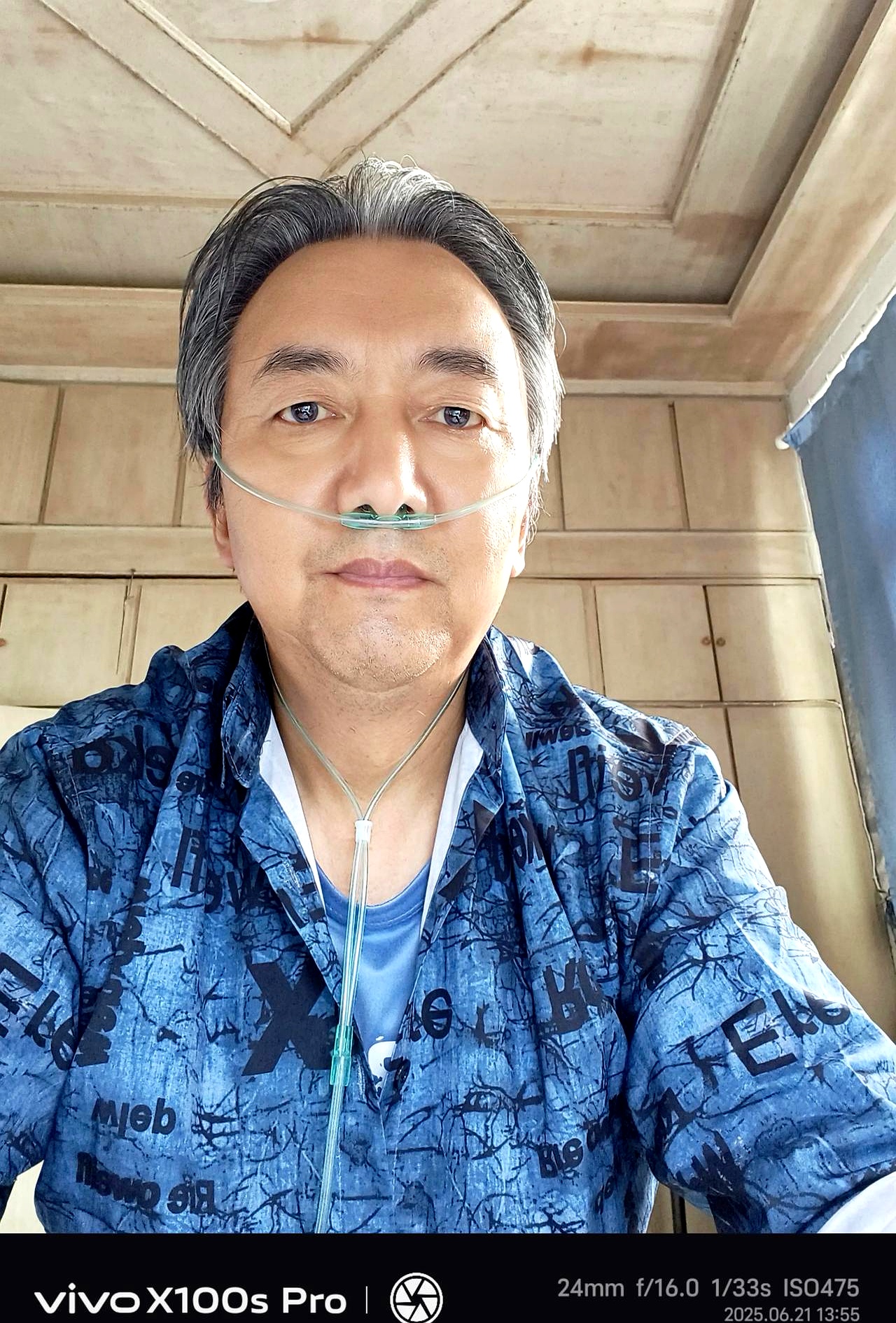 我患有极严重的慢阻肺,伴随二型呼吸衰竭,还有几十