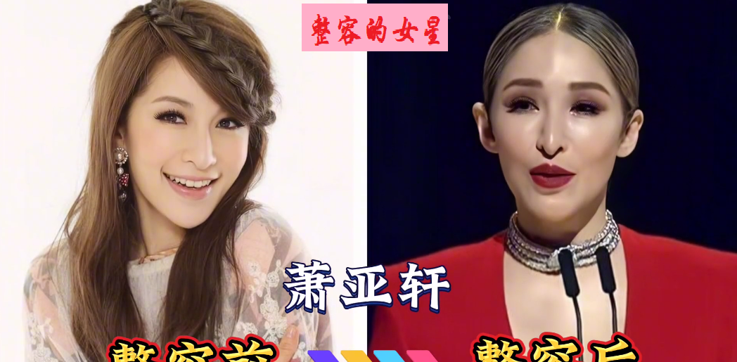 被整容害惨的18位女星,刚出道时她们个个俊美俏丽