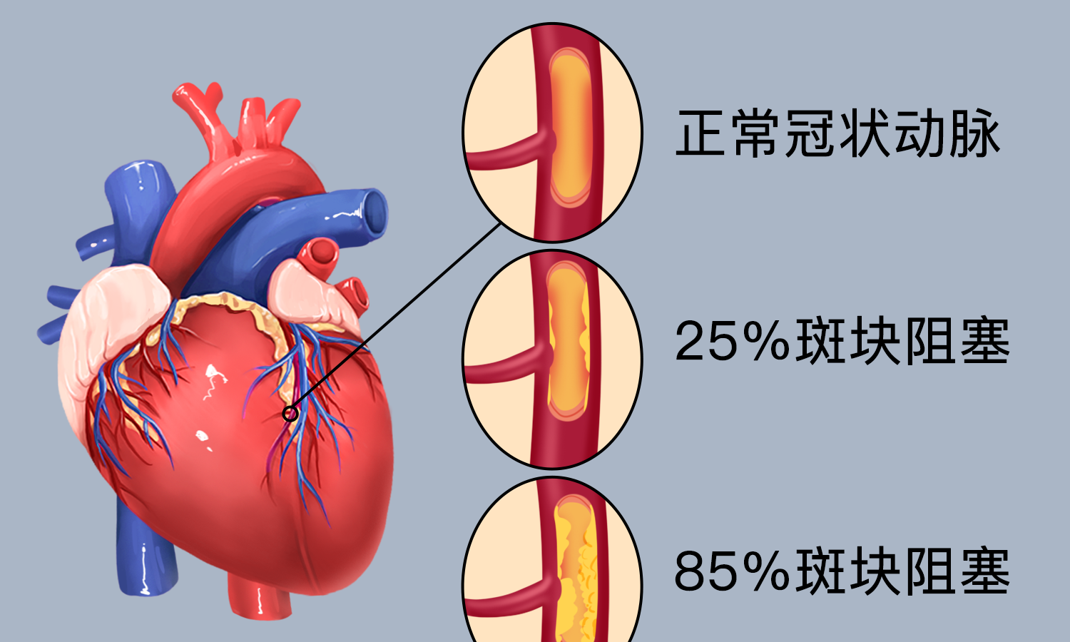 心脏供血不足是个不能忽视的问题