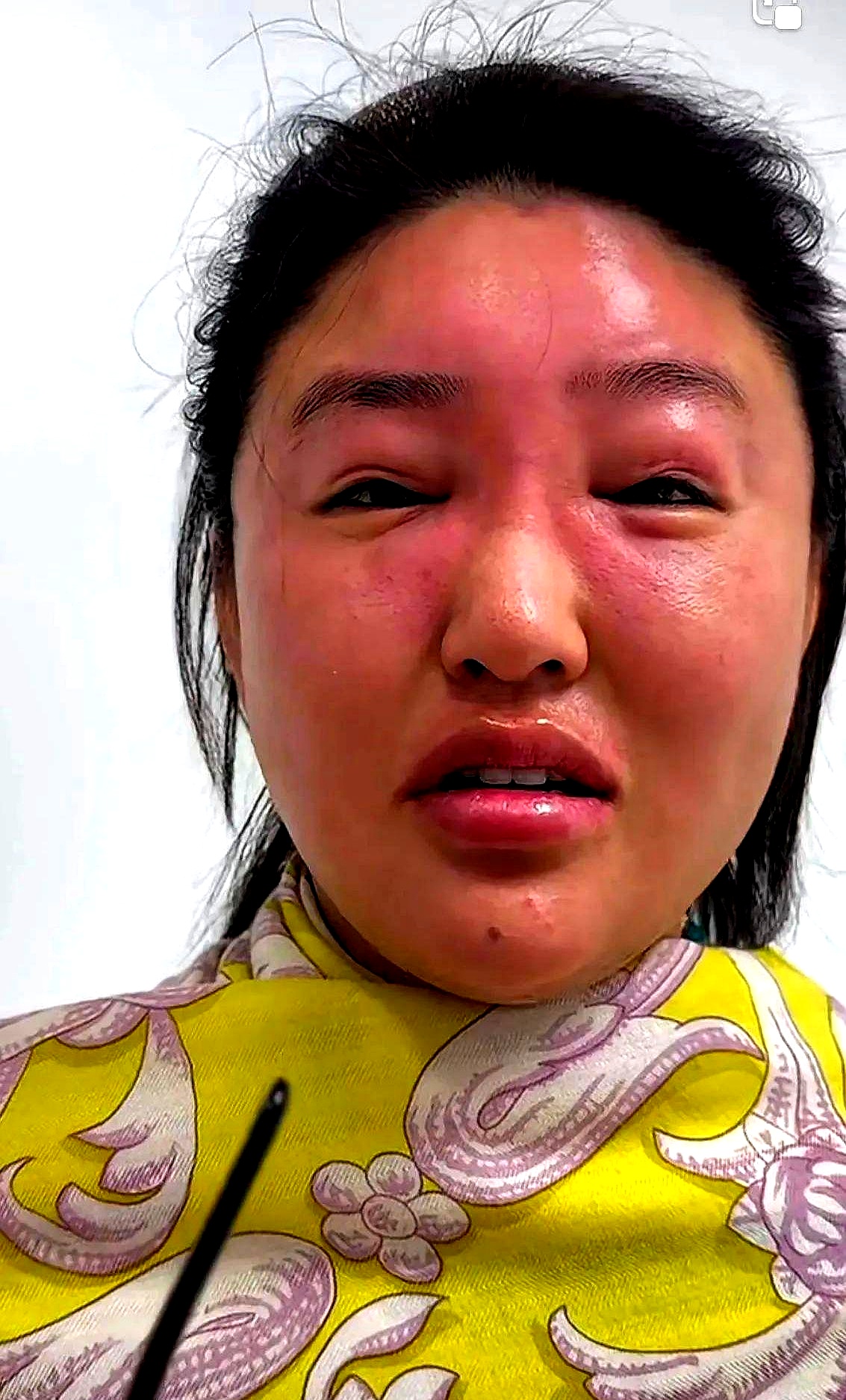 娇娇的手指在屏幕上敲得咚咚响,每点一下都像在敲打赵本山的脸面