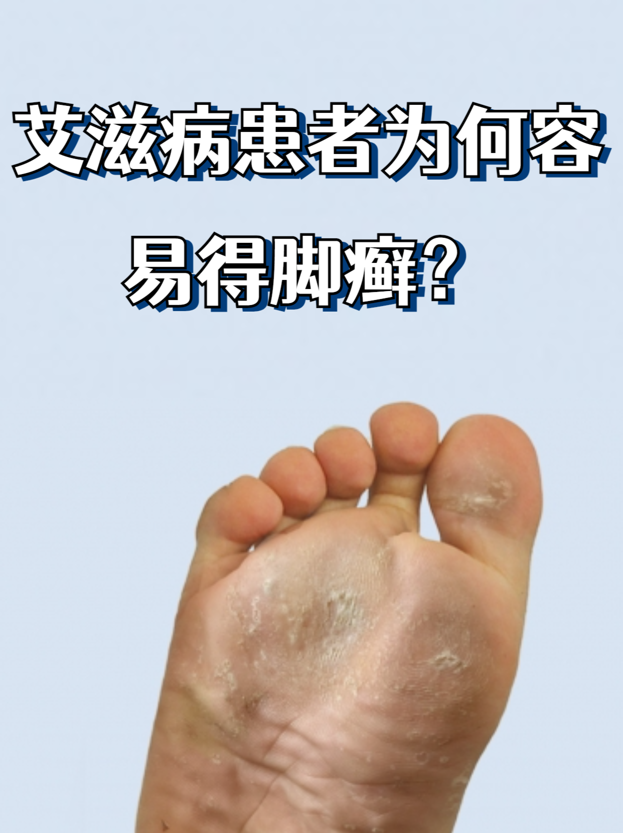 什么样脚藓脚气是什么原因引起的啊足癣图片脚气艾滋病对家人有影响吗