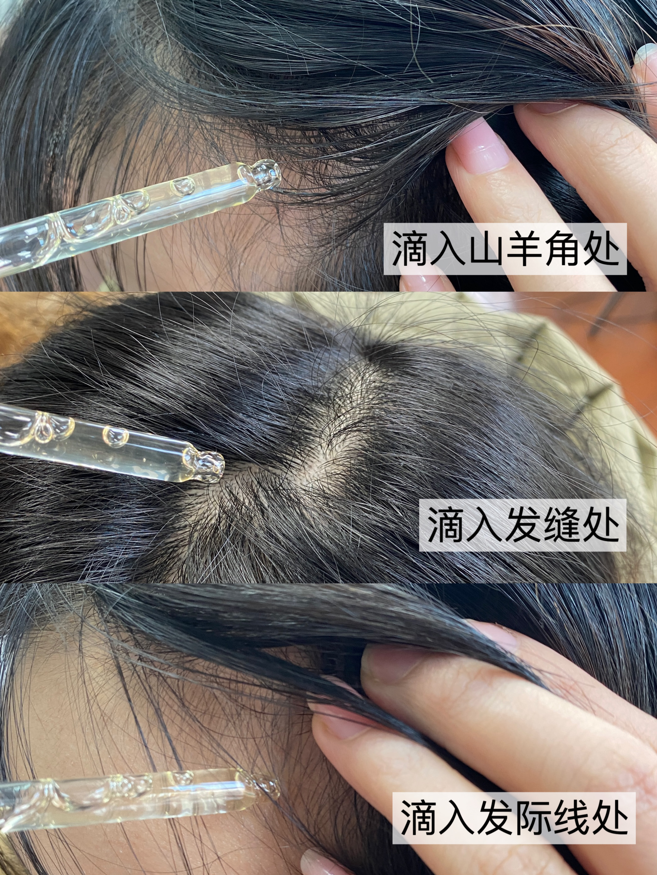 中国唯一认可的生发产品 生发液排行榜前十名 排名第一的防脱