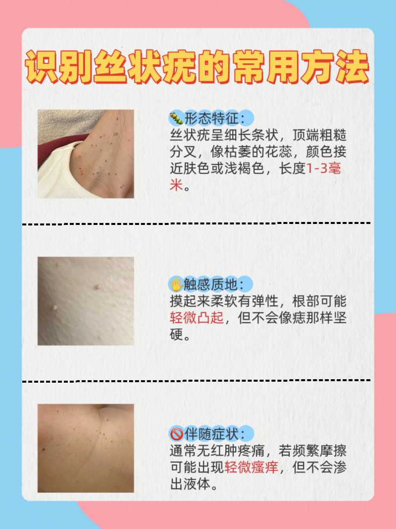 这种小肉条通常不痛不痒,却让人忍不住想揪掉,先别急,咱们得学会区分