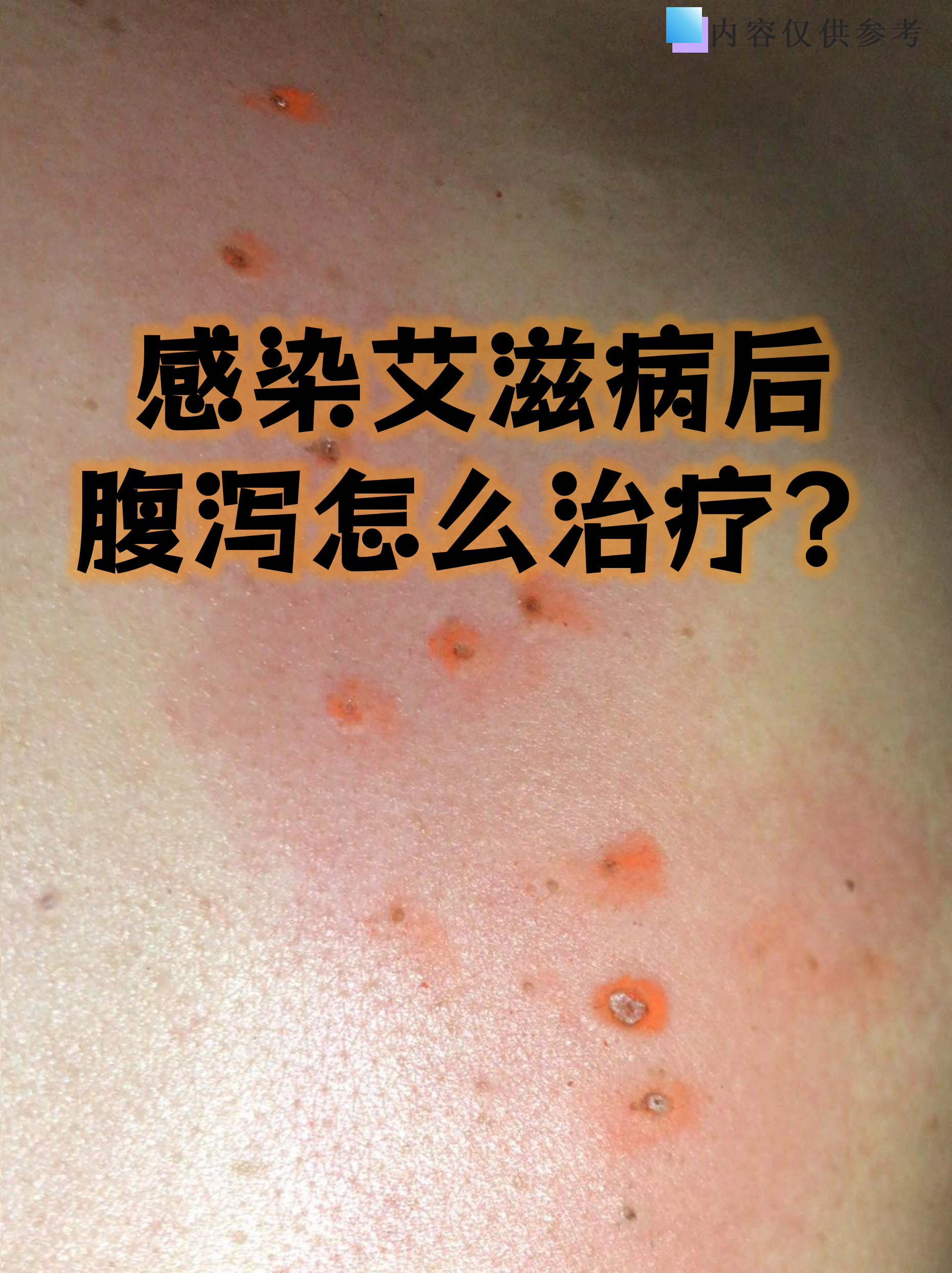  疫情的症状是啥样的(最近疫情的症状表现有哪些)