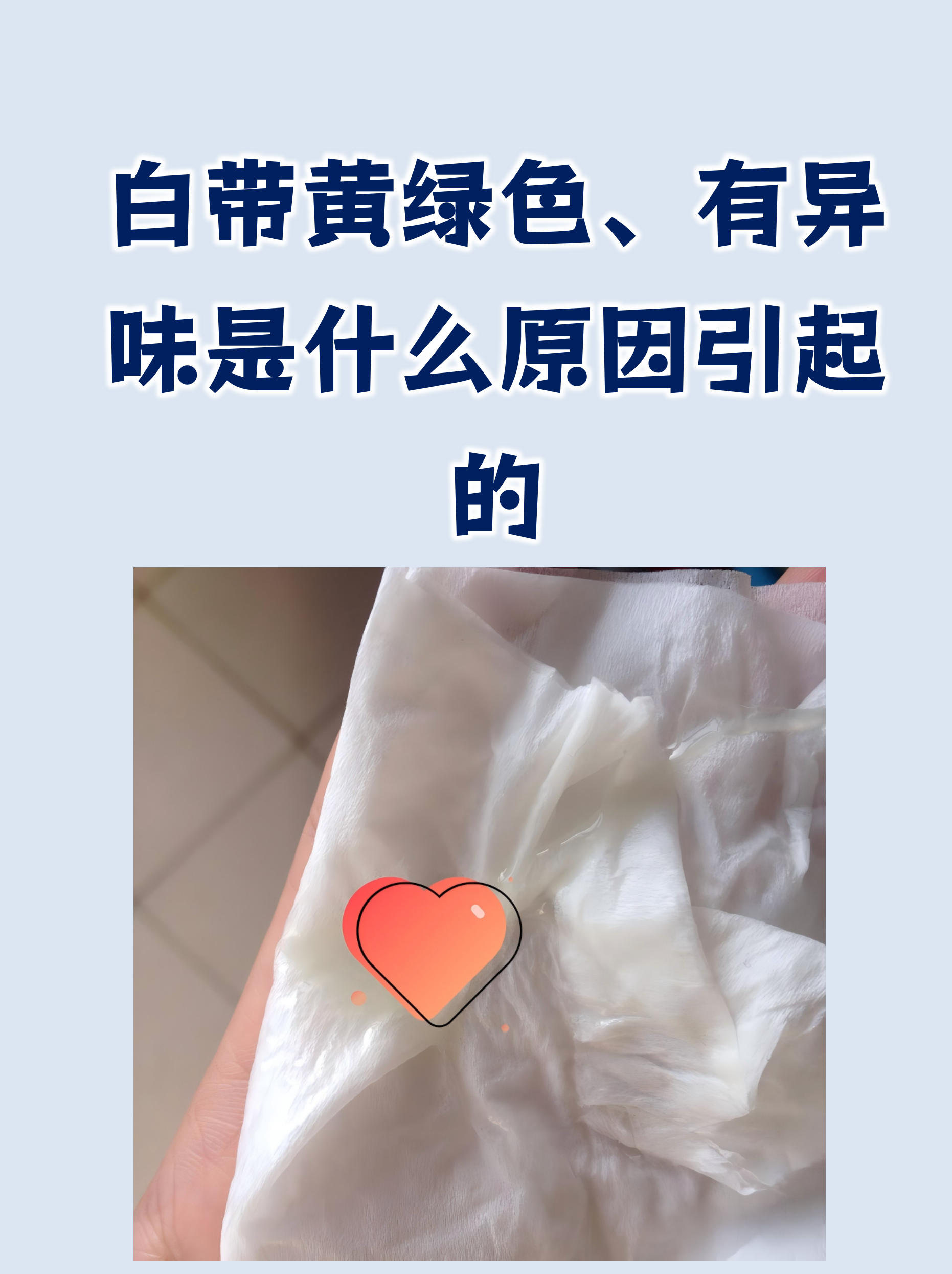白带黄绿色,有异味是什么原因引起的