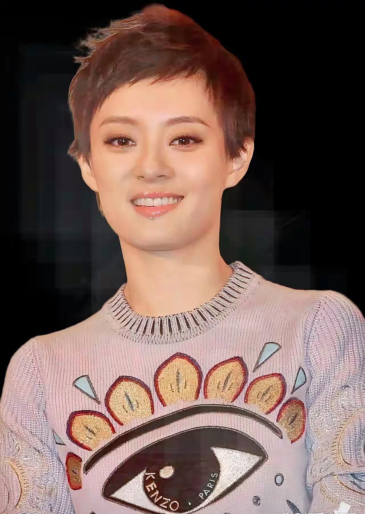 有人说孙俪可能得了甲亢什么的眼睛特别凸又干颜值好像掉了之后
