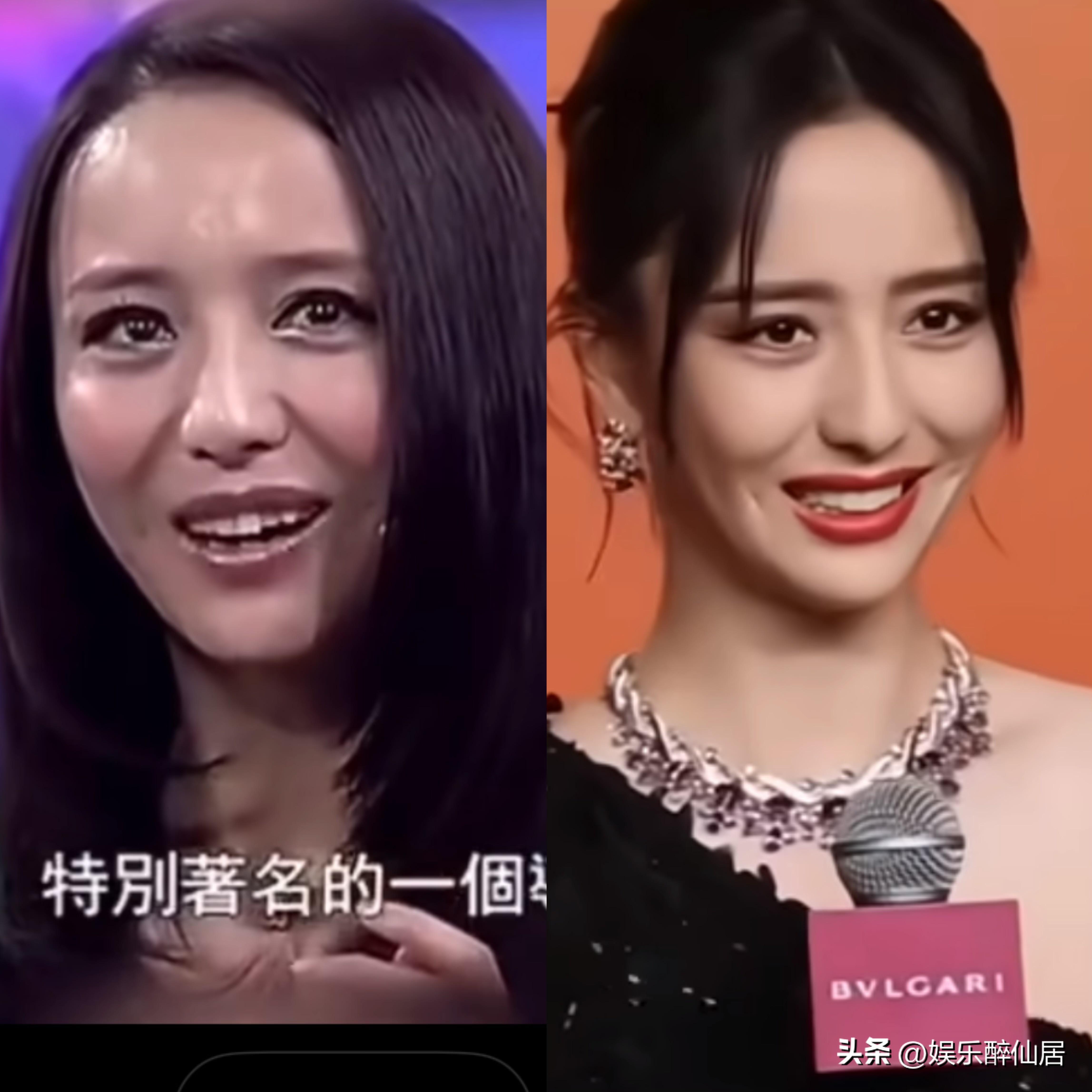 佟丽娅曾被誉为"丑小鸭变白天鹅",早年她的肤色较为黝黑