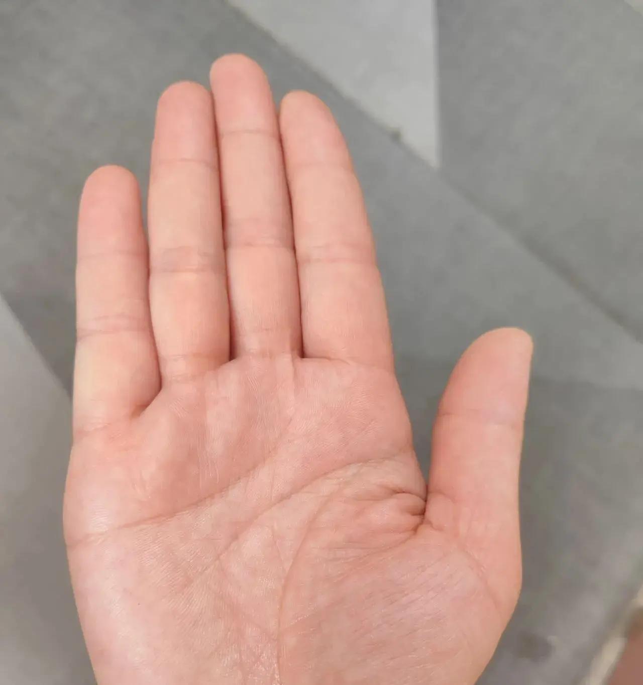 手相一挺蹊跷 女缘主反复投稿求解婚姻运势 她把手摊开我只看了几道