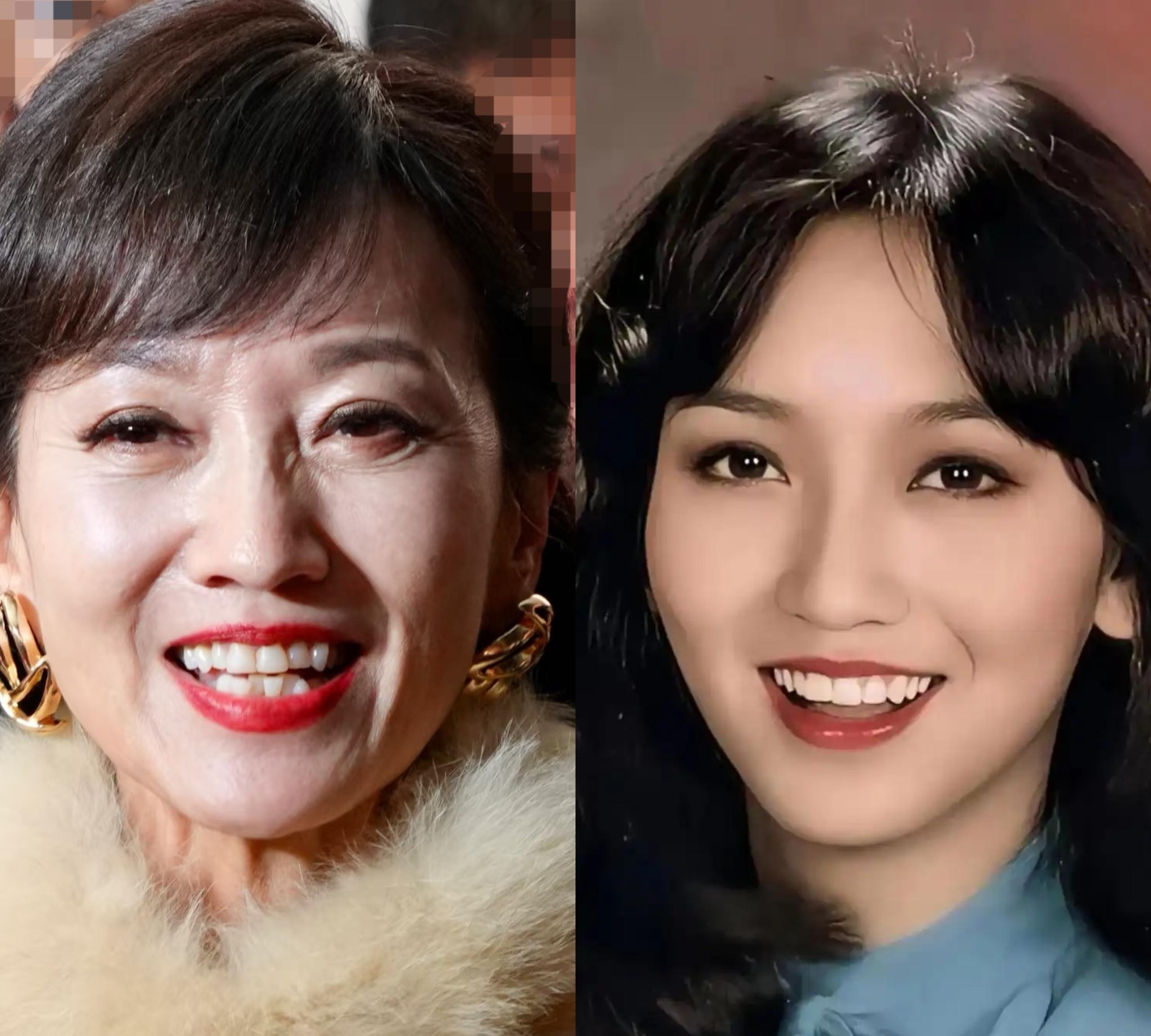 不信你看不老女神赵雅芝,周慧敏这几年笑起来,牙齿就没有年轻时整齐了
