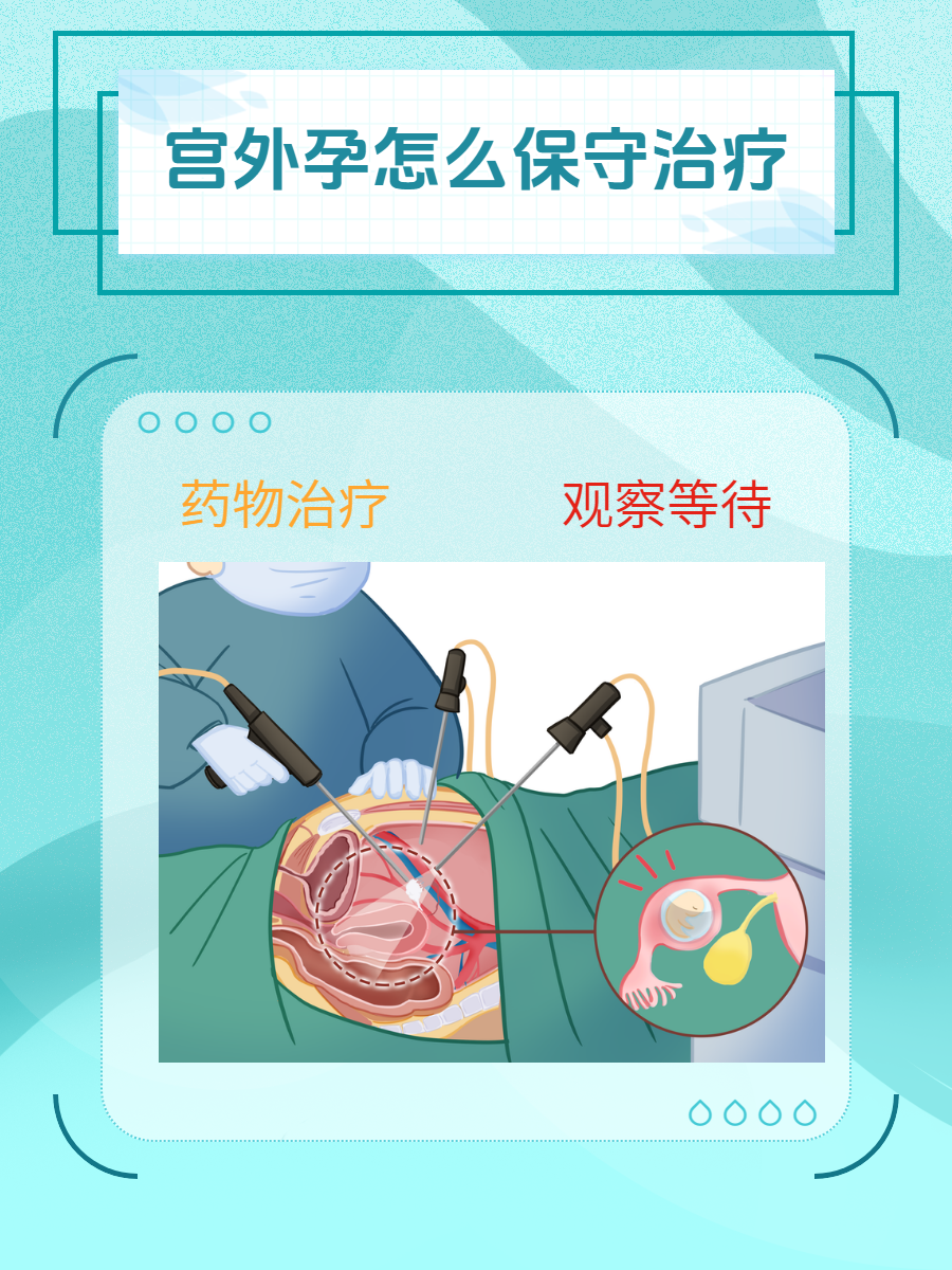 宫外孕怎么保守治疗?