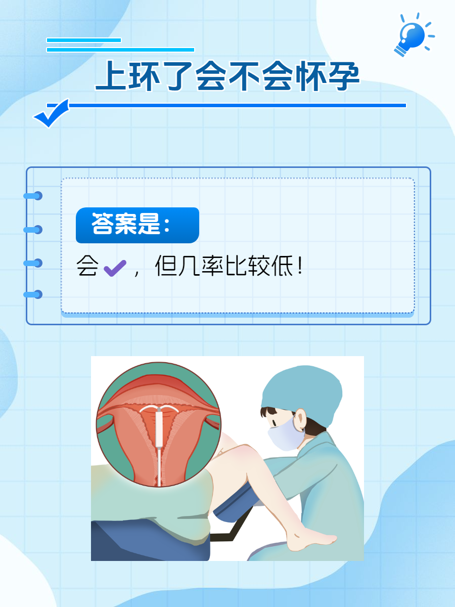 吗上环节育原理上环取环宣传图上环避孕上环为什么会避孕呢上环术配图