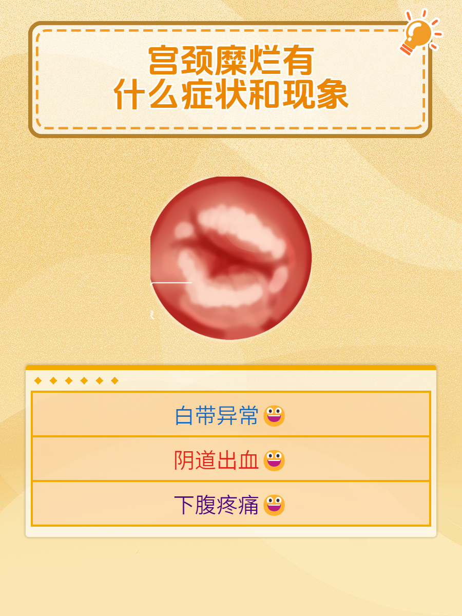 为什么会宫颈糜烂