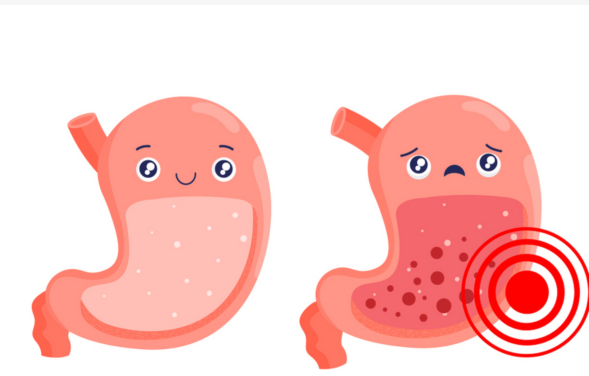 胃有烧灼感,多提示胃酸分泌增多,甚至可因胆汁反流至胃部,引起胃黏膜