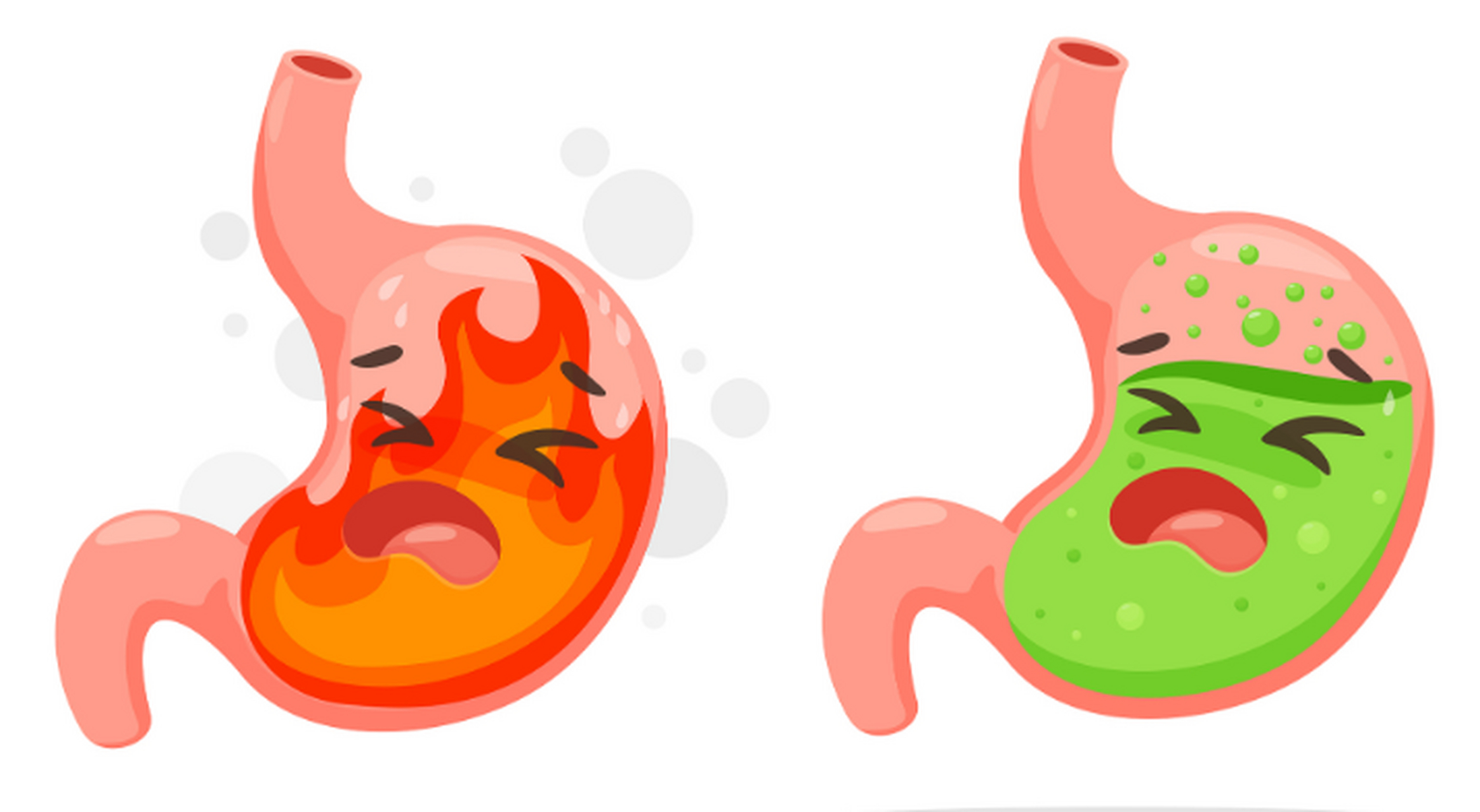 胃食管反流病可因胃酸,食物甚至胆汁反流到食道,引起病人出现反酸