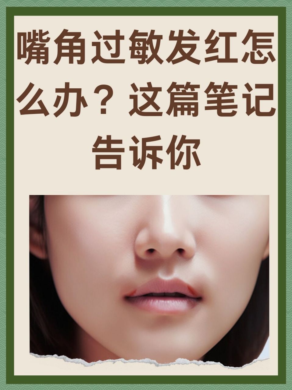 嘴角过敏发红怎么办?