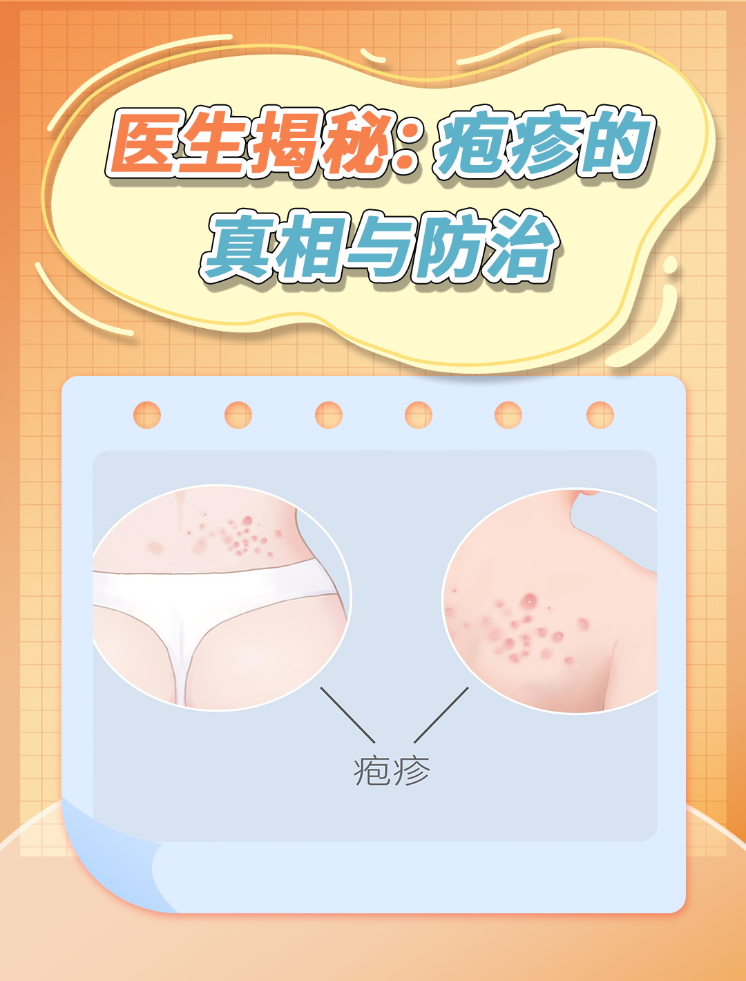 疱疹不仅影响美观,还可能带来不适.