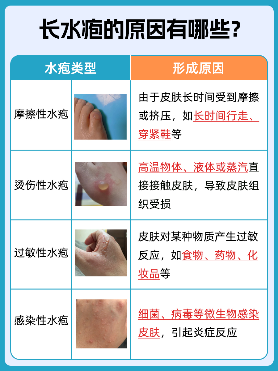 水泡之谜:不戳破,它会自己消失吗?