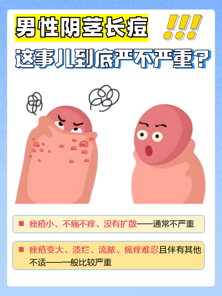 怎么判断严不严重? 不严重的情况:痤疮小,不痛不痒