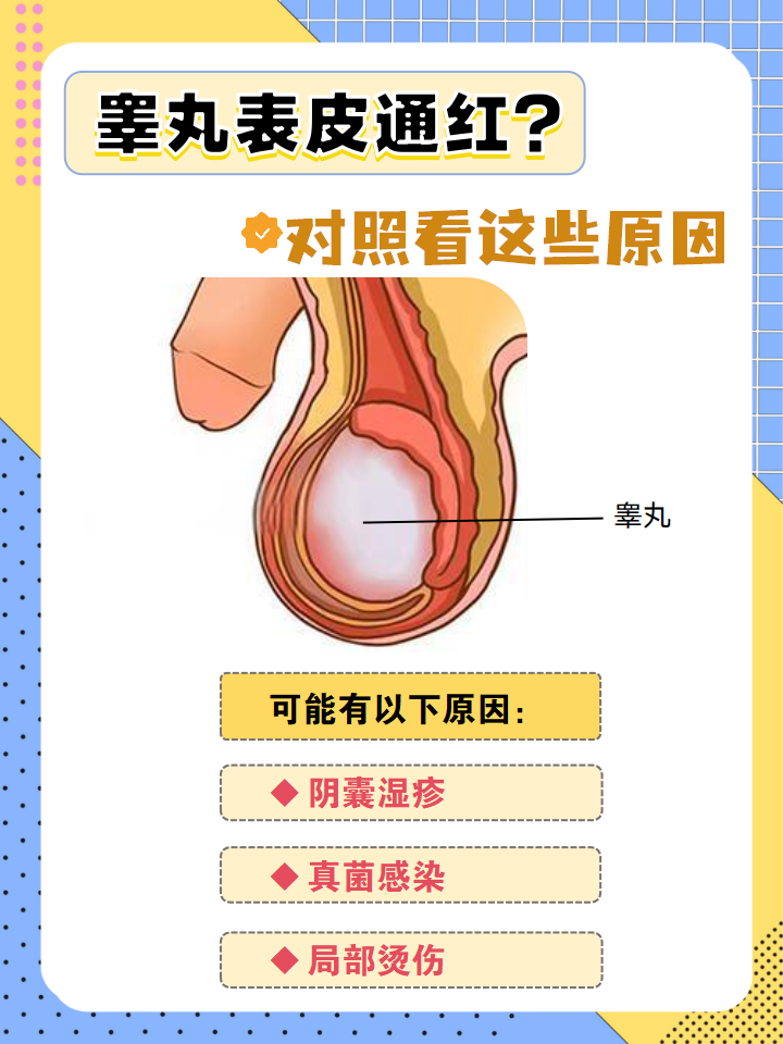 图片男性生殖旁边长了红斑男性阴囊湿疹症状图片阴囊发红图片对照阴囊