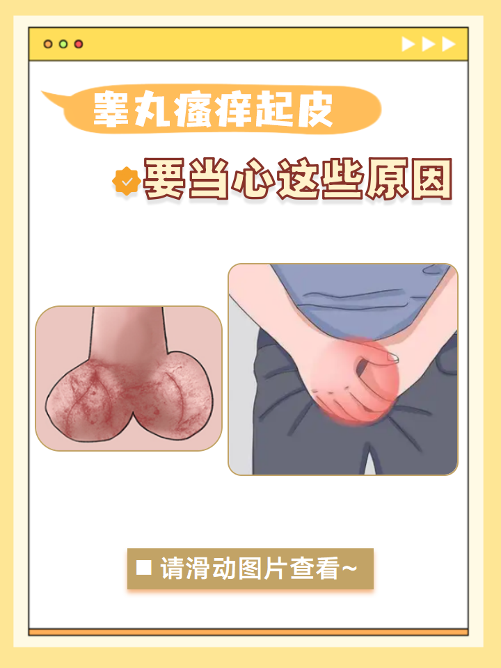 发硬睾丸外皮睾丸皮肤干燥褶皱变硬脱皮怎么回事阴囊细菌感染症状图片