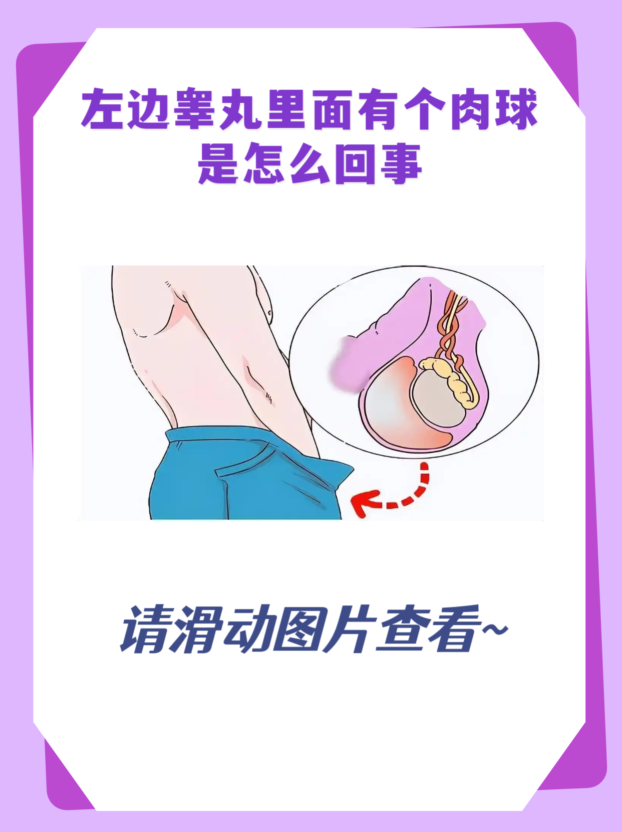 左边睾丸里面有个肉球是怎么回事