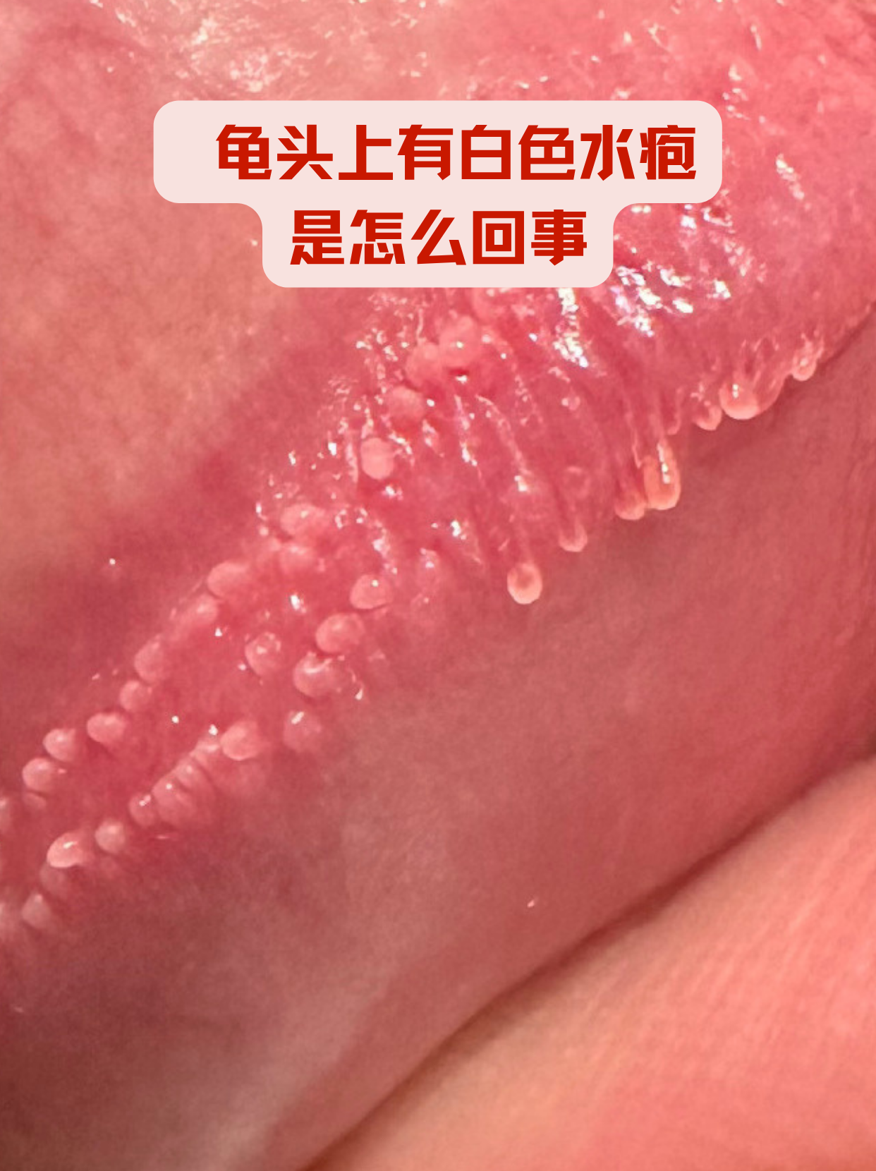 作为医生,我见过不少类似案例,今天就从症状到应对方法给你讲清楚,帮