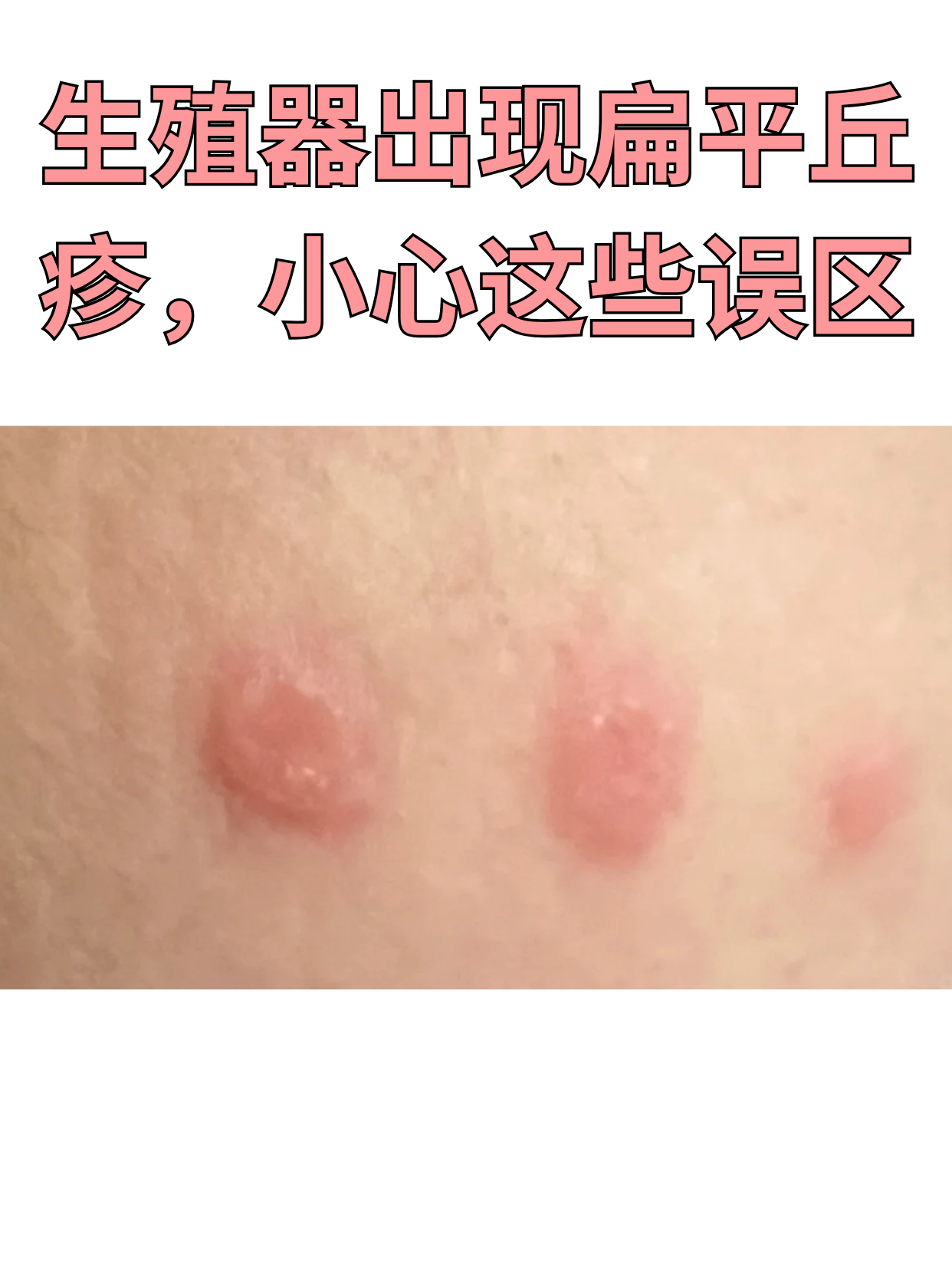 为什么身上会长小疙瘩