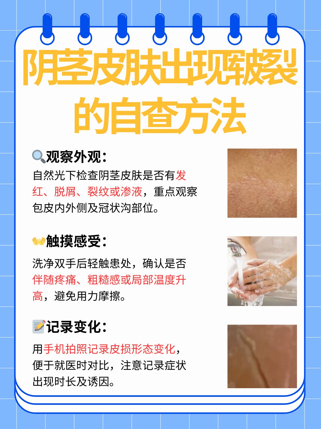 自查阴茎皮肤出现皲裂的方法