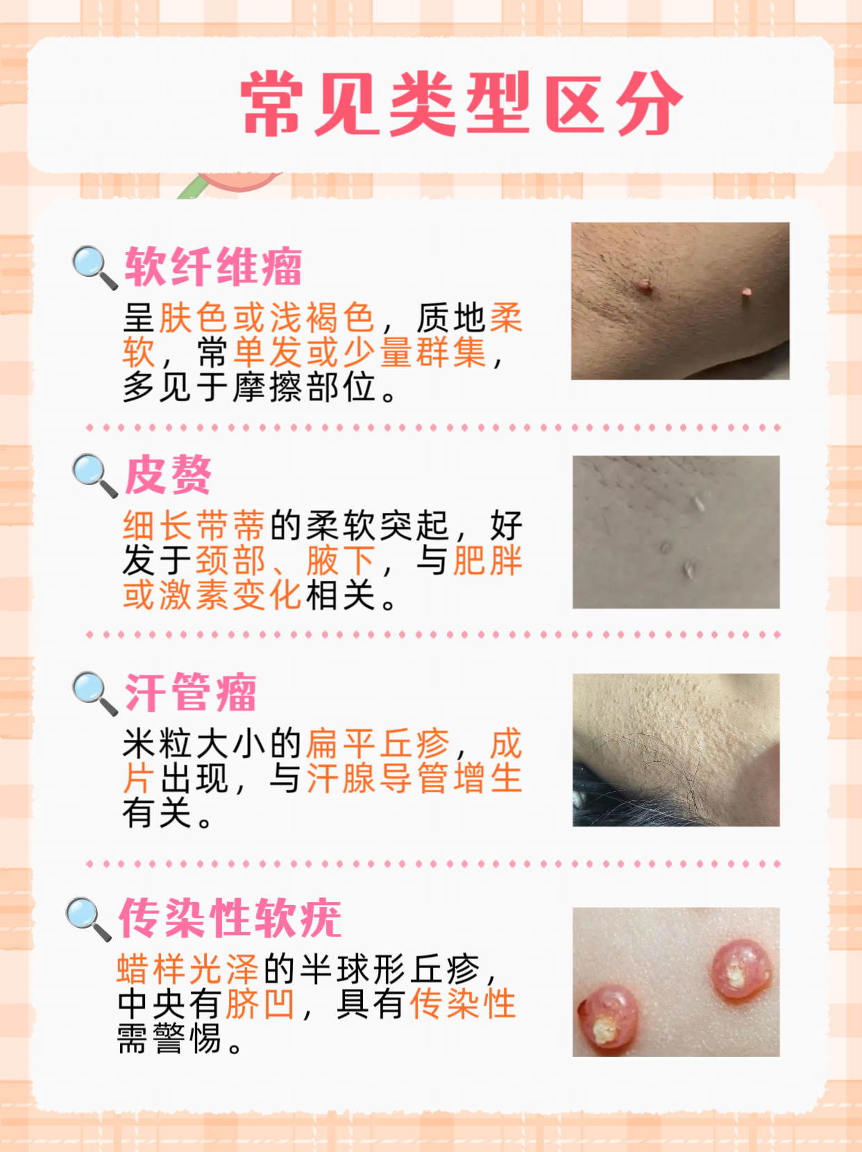 这些肉粒可能是软纤维瘤,皮赘或汗管瘤,虽然多数无害,但处理不当可能