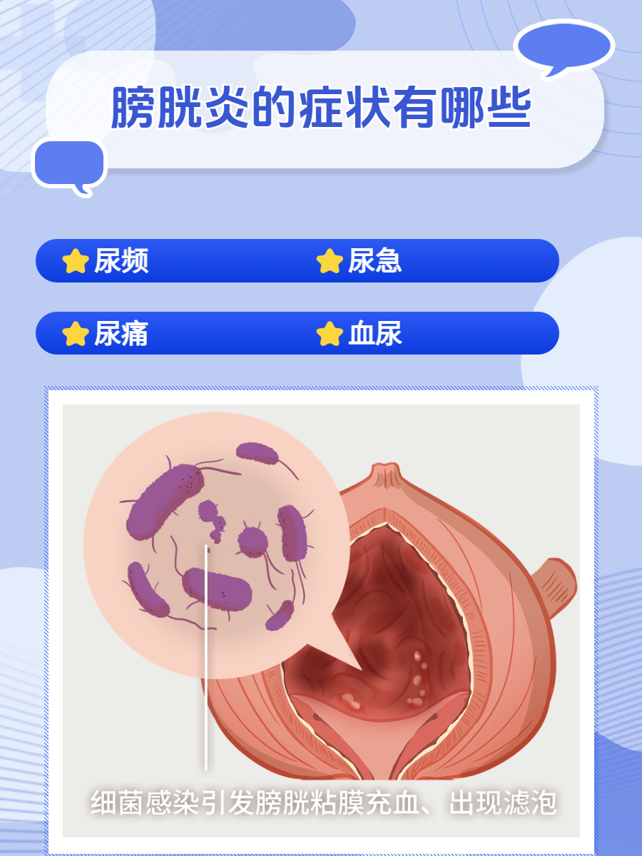 膀胱炎症状有尿频,尿急,尿痛,还可能有血尿,下腹痛